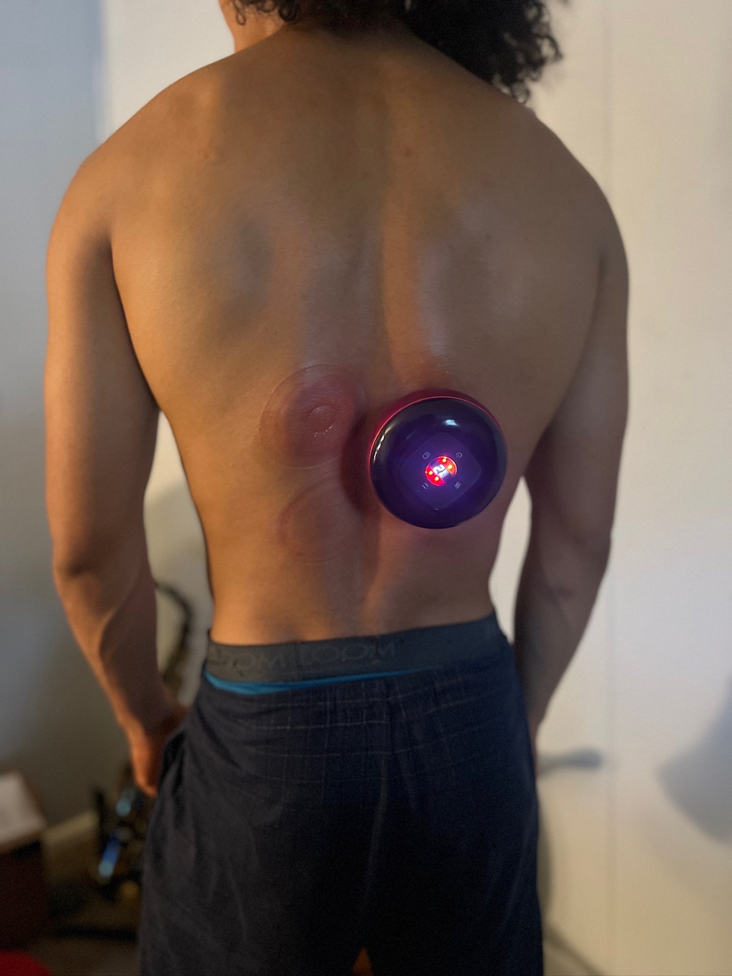 Stimulating Dynamic Cupping Therapy Set